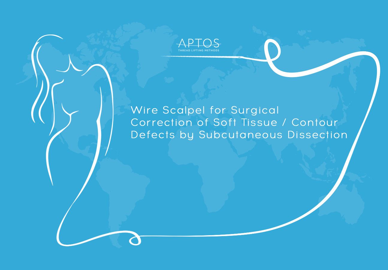 Wire Scalpel for Surgical Correction of Soft Tissue